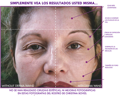 LÁPIZ FACIAL ESTIMULADOR DERMA WAND